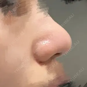 リッツ美容外科 大阪院口コミ