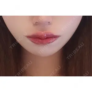 口コミ