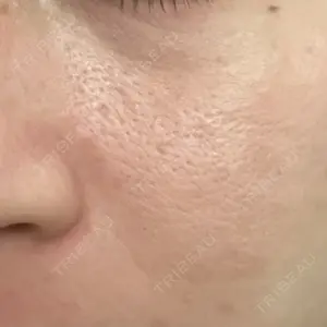 ルネッサンス美容外科医院の口コミ