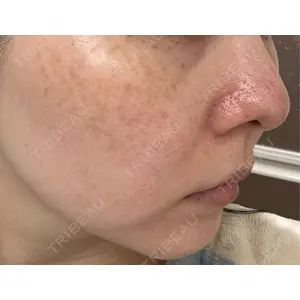 ルラ美容クリニック ルラ美容クリニック 広島院口コミ