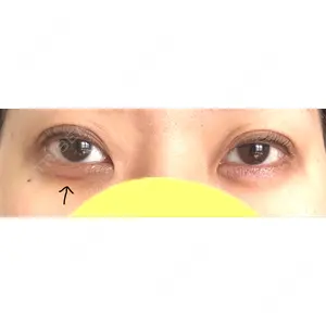 さっぽろ美容クリニック口コミ