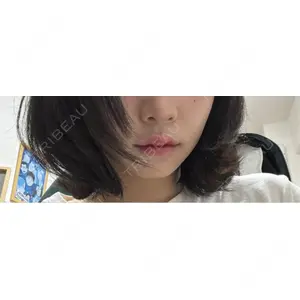 ルラ美容クリニック ルラ美容クリニック 大阪心斎橋院口コミ