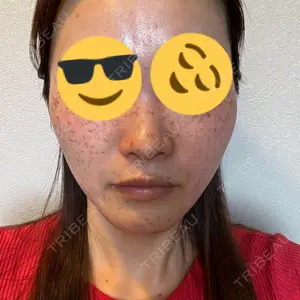 東京美容クリニックの口コミ