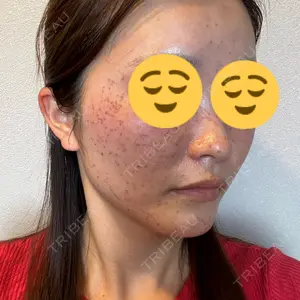 東京美容クリニックの口コミ