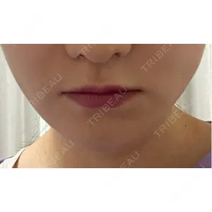 アリエル美容クリニック アリエル美容クリニック 横浜院口コミ