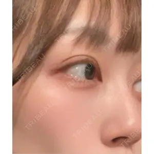 口コミ