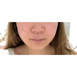 口コミ
