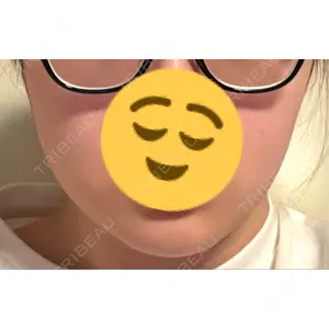 DMTC美容皮膚科 DMTC美容皮膚科 大宮院口コミ