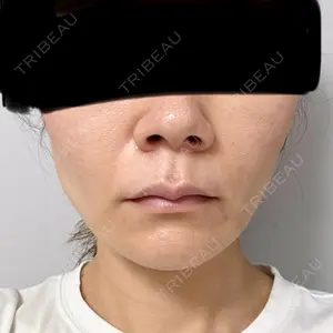 湘南美容クリニック 秋葉原院口コミ