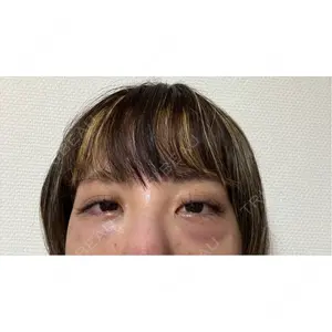 口コミ