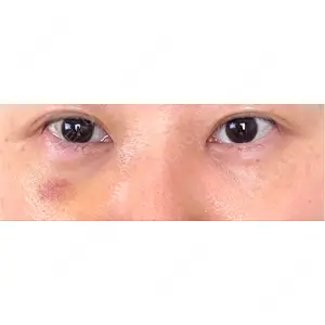 藤・ナチュレ美容クリニック 藤・ナチュレ美容クリニック 銀座院口コミ