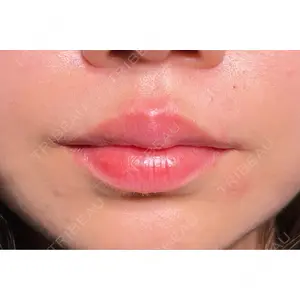 HAAB×DREAM BEAUTY CLINIC HAAB×DREAM BEAUTY CLINIC 大阪梅田院口コミ