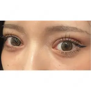 藤・ナチュレ美容クリニック 藤・ナチュレ美容クリニック 銀座院口コミ