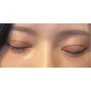 藤・ナチュレ美容クリニック 藤・ナチュレ美容クリニック 銀座院口コミ
