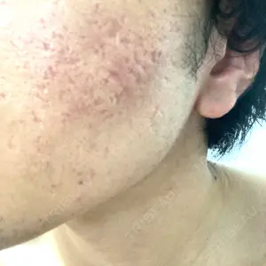 PRISM Beauty Clinic口コミ