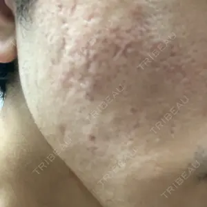 PRISM Beauty Clinic口コミ