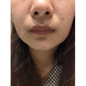 渋谷美容外科クリニックの口コミ
