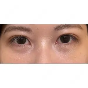 藤・ナチュレ美容クリニック 藤・ナチュレ美容クリニック 銀座院口コミ