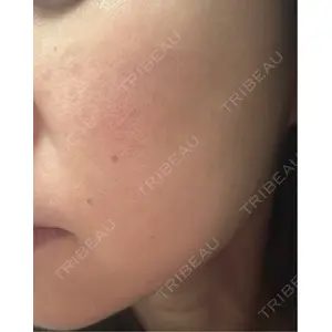 RAISE CLINIC 【レイズクリニック】口コミ