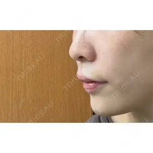 EMMO FACE CLINIC EMMO FACE CLINIC 大宮院口コミ