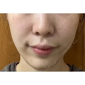 EMMO FACE CLINIC EMMO FACE CLINIC 大宮院口コミ