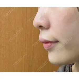EMMO FACE CLINIC EMMO FACE CLINIC 大宮院口コミ