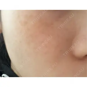 ルラ美容クリニック ルラ美容クリニック 新宿院口コミ