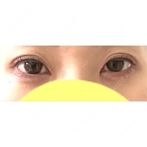 さっぽろ美容クリニック口コミ