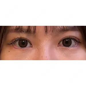 口コミ