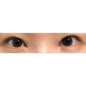 いちのせ形成外科・皮膚科 眼瞼＆フェイスクリニック口コミ