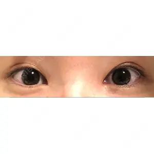 いちのせ形成外科・皮膚科 眼瞼＆フェイスクリニック口コミ
