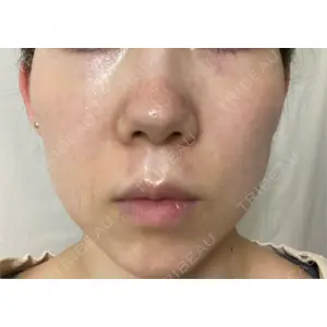 口コミ
