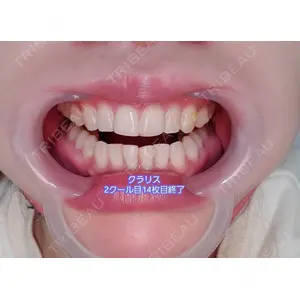 口コミ