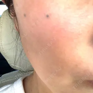 ルラ美容クリニック ルラ美容クリニック 福岡院口コミ