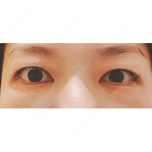 口コミ