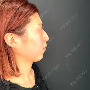 HAAB×DREAM BEAUTY CLINIC HAAB×DREAM BEAUTY CLINIC 大阪梅田院口コミ