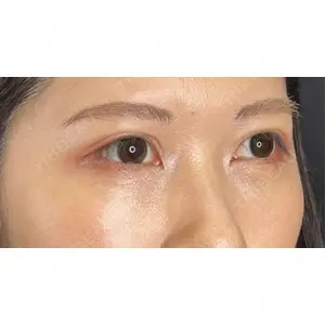 藤・ナチュレ美容クリニック 藤・ナチュレ美容クリニック 銀座院口コミ