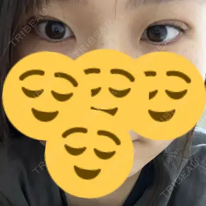 湘南美容クリニック 湘南美容クリニック 名古屋栄院口コミ