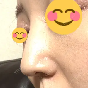 口コミ