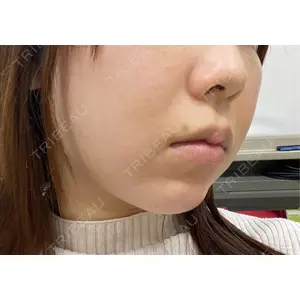 口コミ