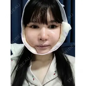 リッツ美容外科の口コミ