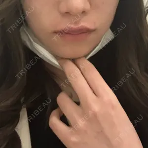 ルラ美容クリニック ルラ美容クリニック 大阪心斎橋院口コミ