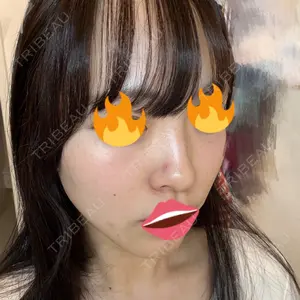 口コミ