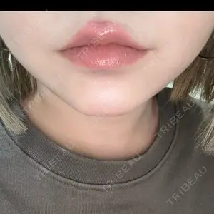 口コミ