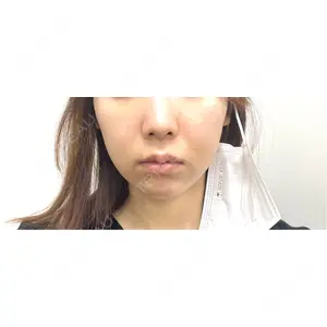 口コミ