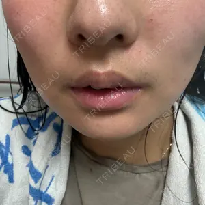 口コミ
