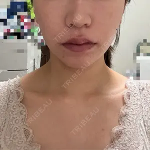 口コミ