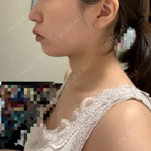 口コミ