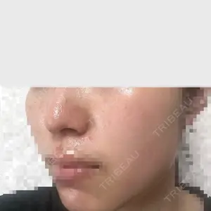 ルラ美容クリニック ルラ美容クリニック 高田馬場院口コミ