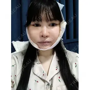 リッツ美容外科の口コミ